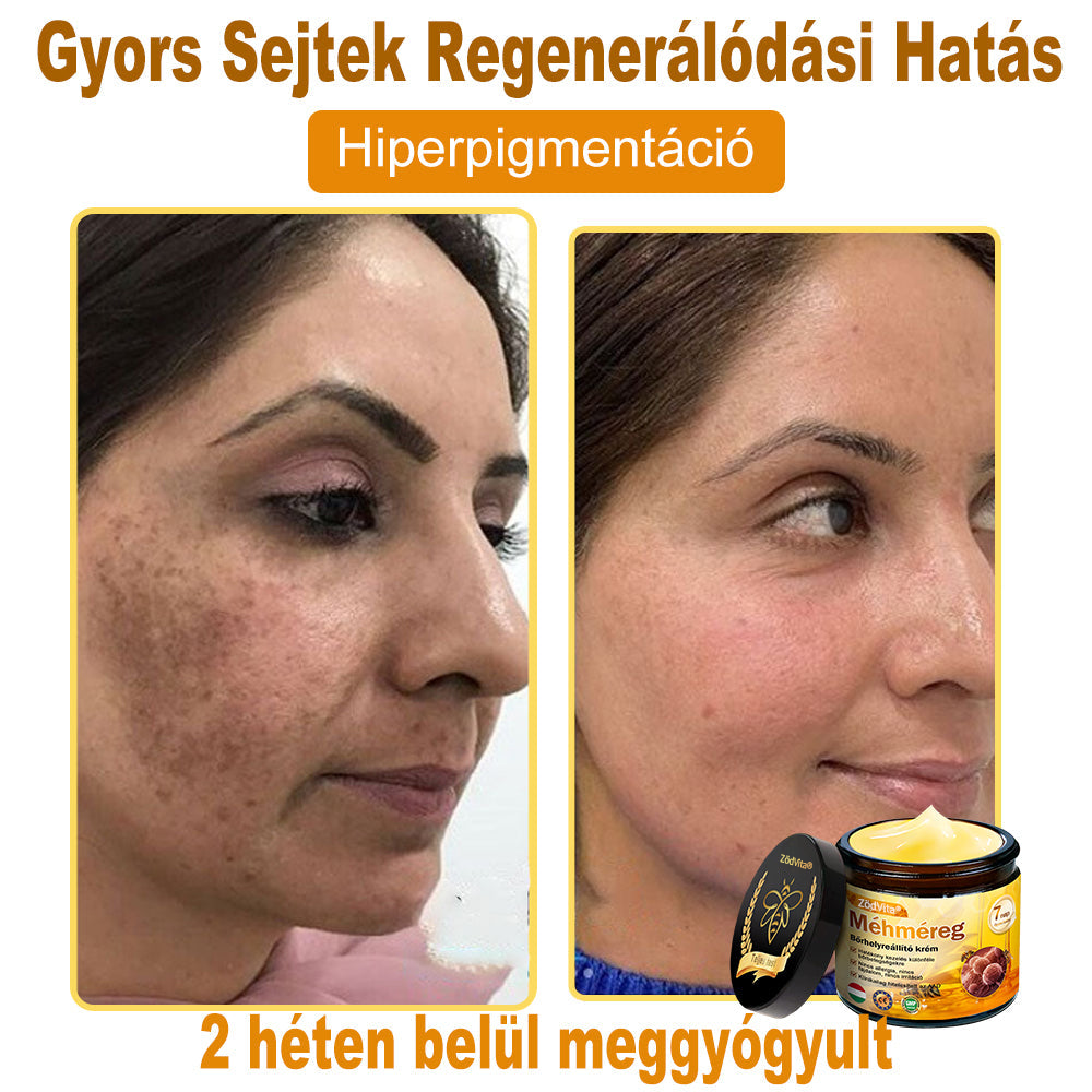 HU🐝✨ ZödVita® Méhméreg Bőr Helyreállító Krém 🔥 Magyar fejlesztés, magyarországi gyártás és szállítás