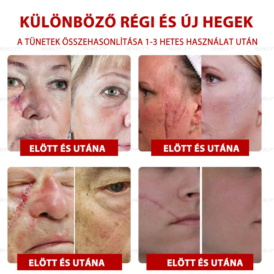 🌺REHELY™ Sejtregeneráló Hidratáló Krém