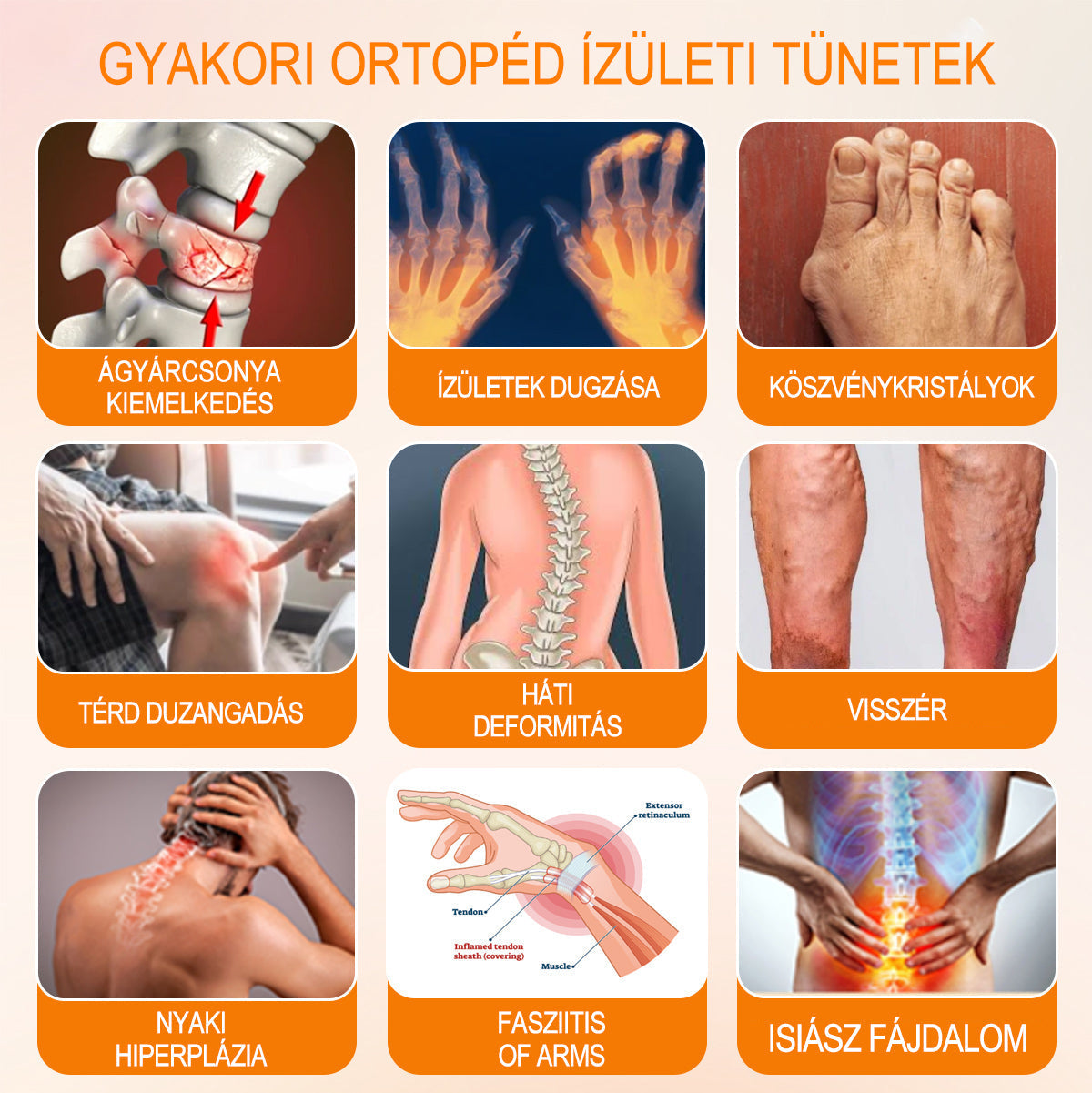 Gbpurity™ - Méhmérég És Glükózamin Ízületi Gyógy Krém👨⚕️A Magyar Ortopéd Társaság (MOT) Által Jóváhagyva