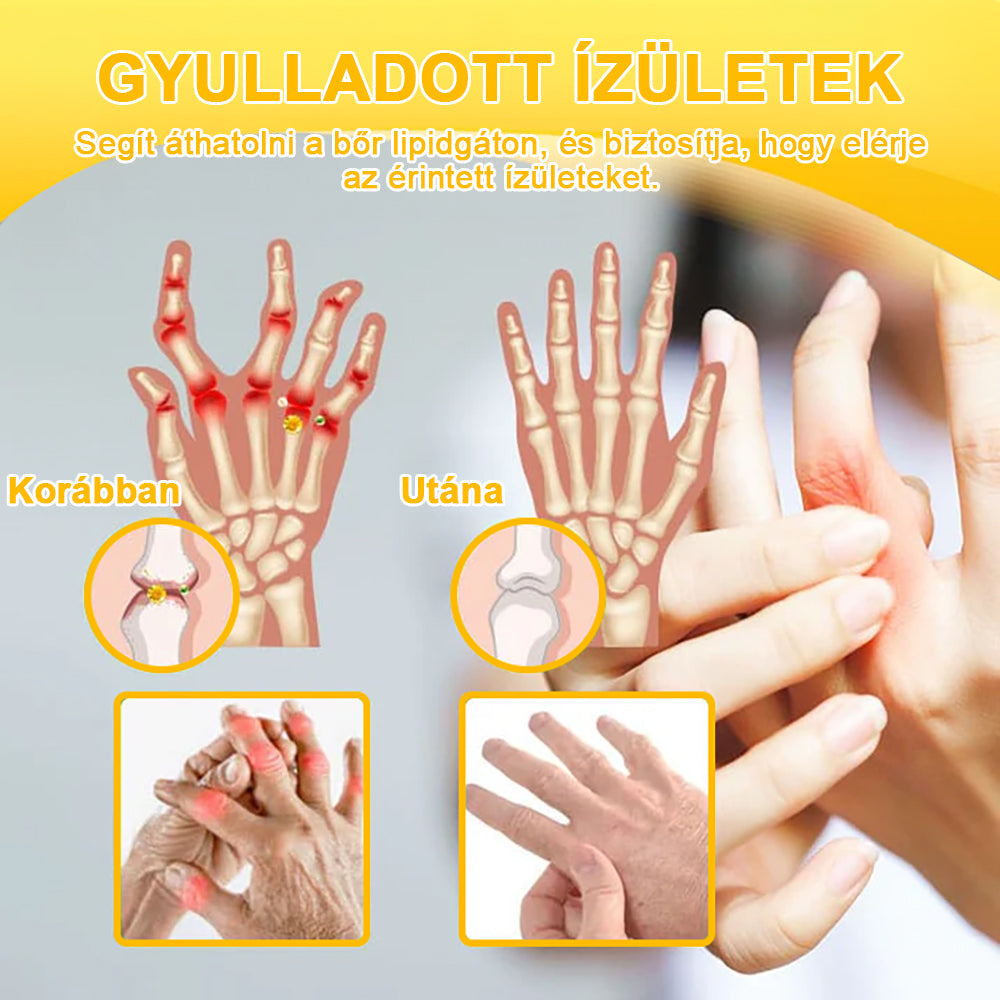 1️⃣ Gbpurity™ Méhmérég És Glükózamin Ízületi Gyógy Krém|TARTALMAZ MÉHMÉREG PEPTIDET, GLÜKÓZAMINT ÉS ARNIKÁT