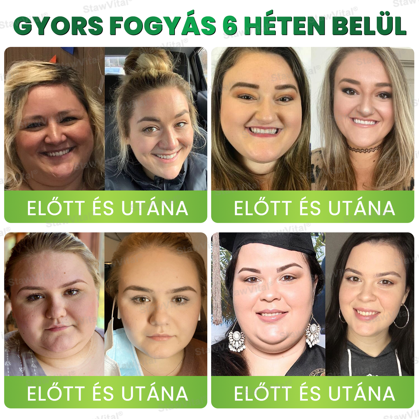 Klymoza® GLP-1 BioMetabolikus Cseppek 🏆🏆(Élelmiszeripari zsírégető – Az Elhízási Társaság fejlesztette)