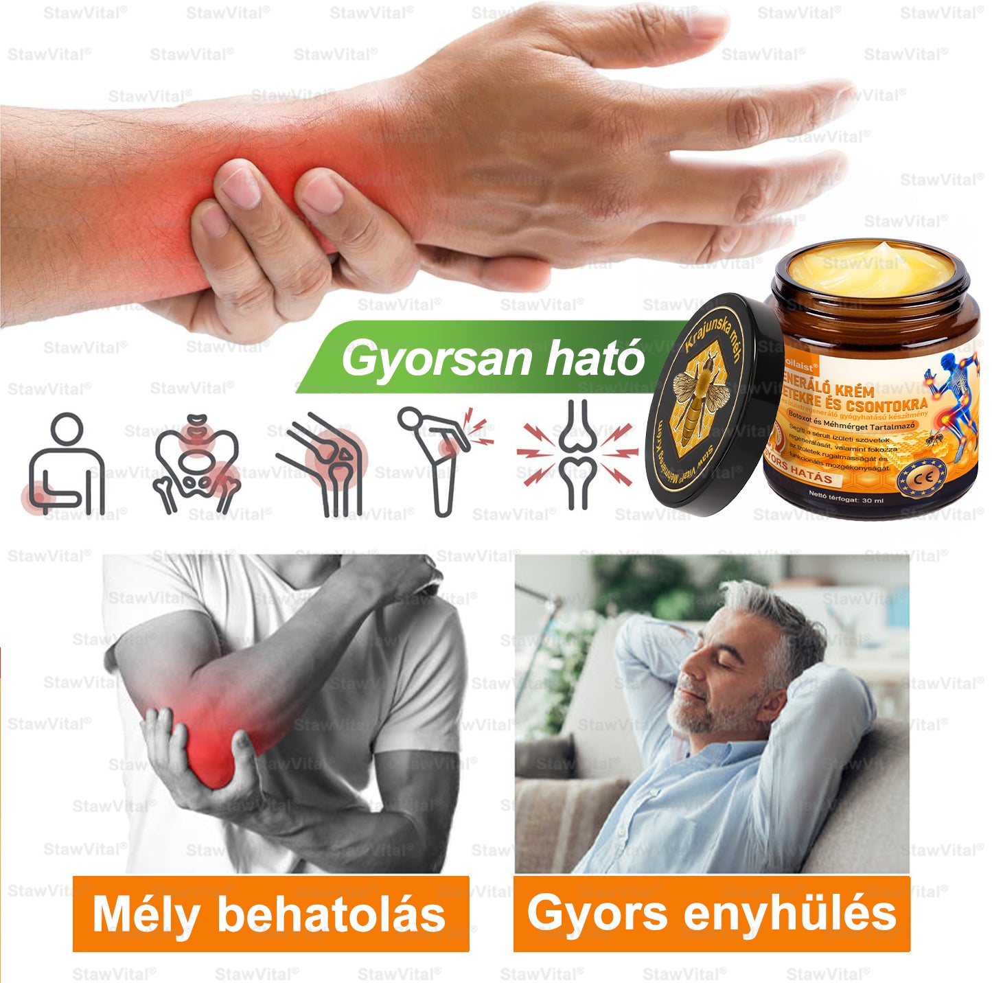 𝑺𝒕𝒂𝒘𝑽𝒊𝒕𝒂𝒍® Botoxot és Méhmérget Tartalmazó Regeneráló Krém Ízületekre és Csontokra | MOT (Magyar Ortopéd Társaság) által tanúsított termék