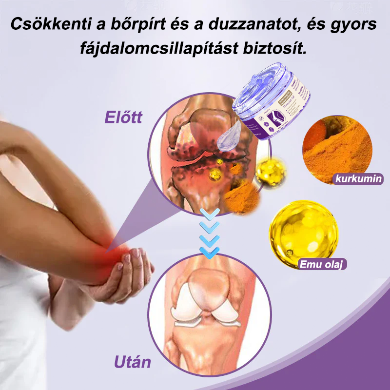 🌿𝐎𝐫𝐮𝐚𝐅𝐥𝐞𝐱™ Kurkuma & Emu Olaj Ízületi Fájdalomcsillapító Masszázs Gél👨⚕️Középkorúaknak és időseknek készült