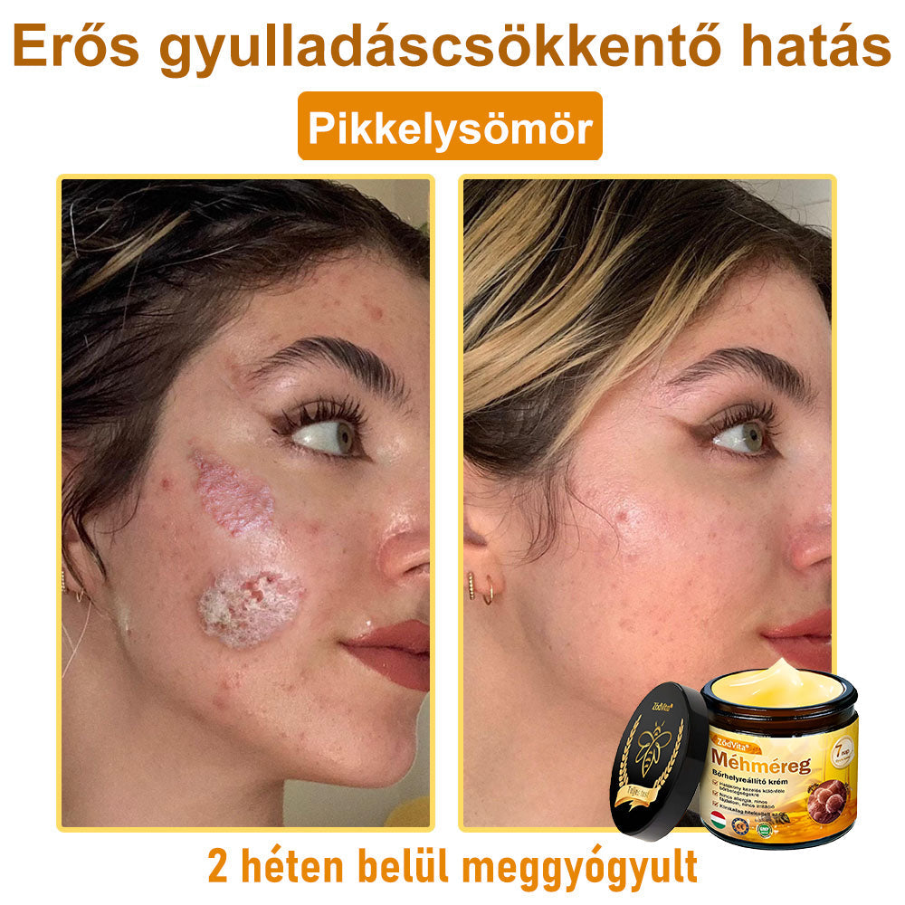 HU🐝✨ ZödVita® Méhméreg Bőr Helyreállító Krém 🔥 Magyar fejlesztés, magyarországi gyártás és szállítás