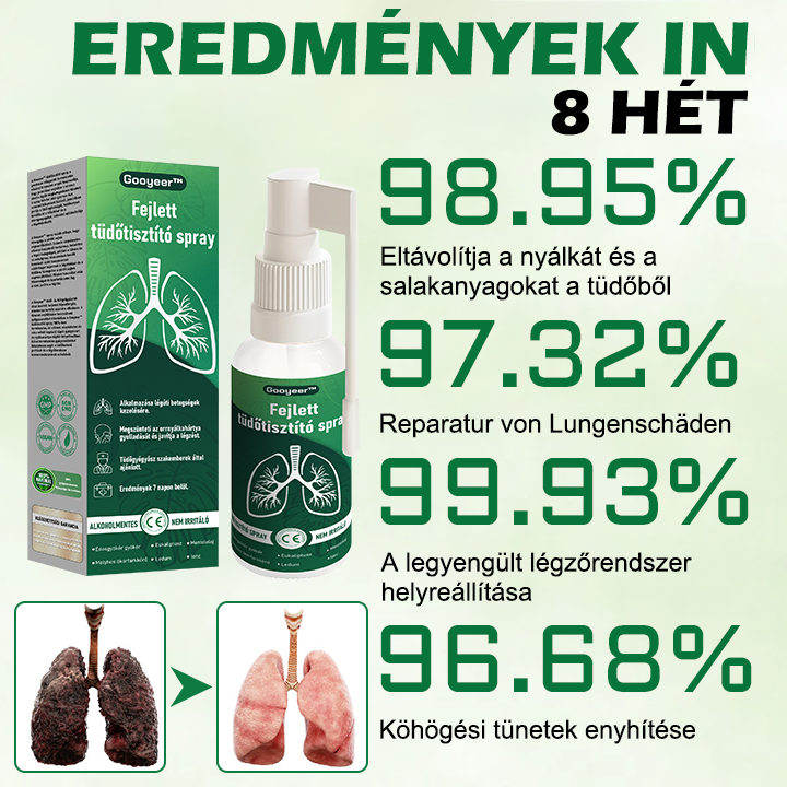 🍀𝐆𝐨𝐨𝐲𝐞𝐞𝐫™ Fejlett Tüdőtisztító Spray -Támogatja a tüdő, a hörgők és az orrmelléküregek egészségét, elősegíti a légzőrendszer egészségét és a könnyebb légzést