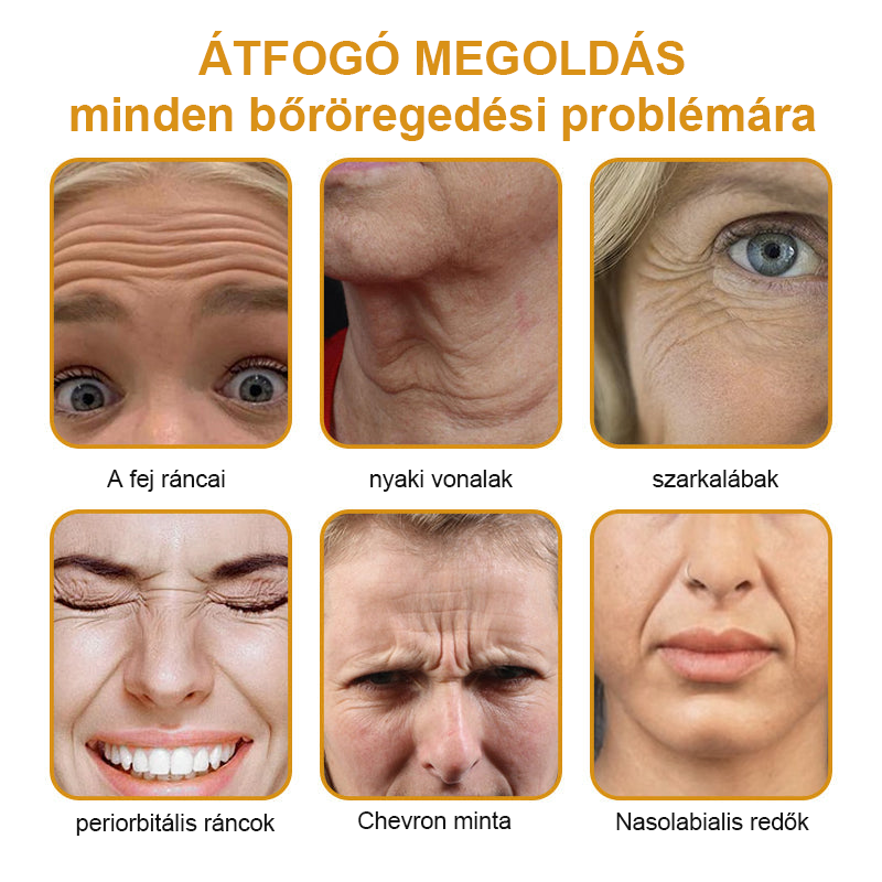 FrissArc™ Botox Méhméreg Ránctalanító Krém