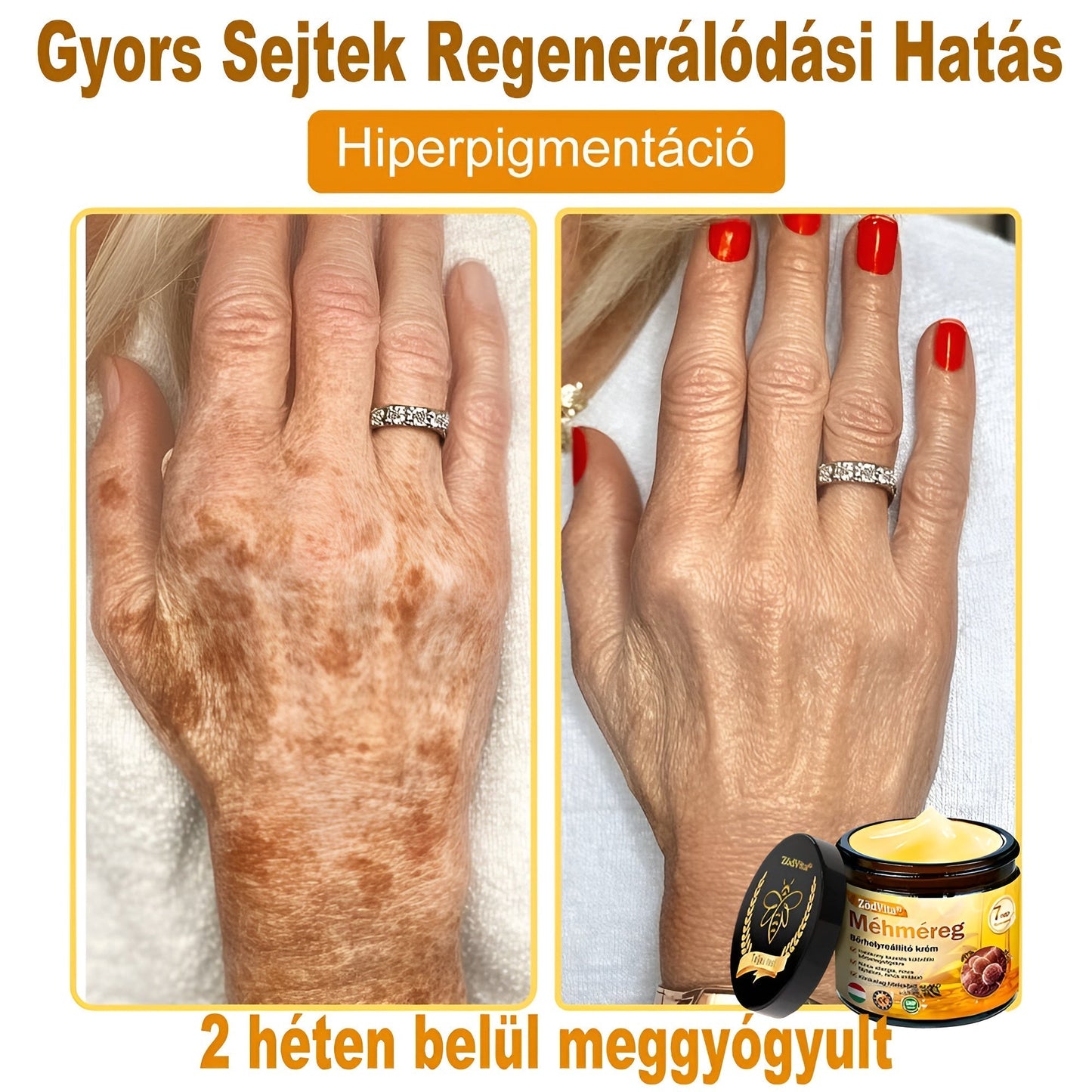 HU🐝✨ ZödVita® Méhméreg Bőr Helyreállító Krém 🔥 Magyar fejlesztés, magyarországi gyártás és szállítás