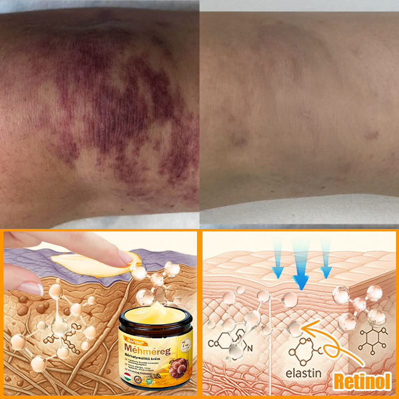 🐝🐝 ZödVita® Méhméreg Bőr Helyreállító Krém (👨⚕CE jóváhagyott)👍✅