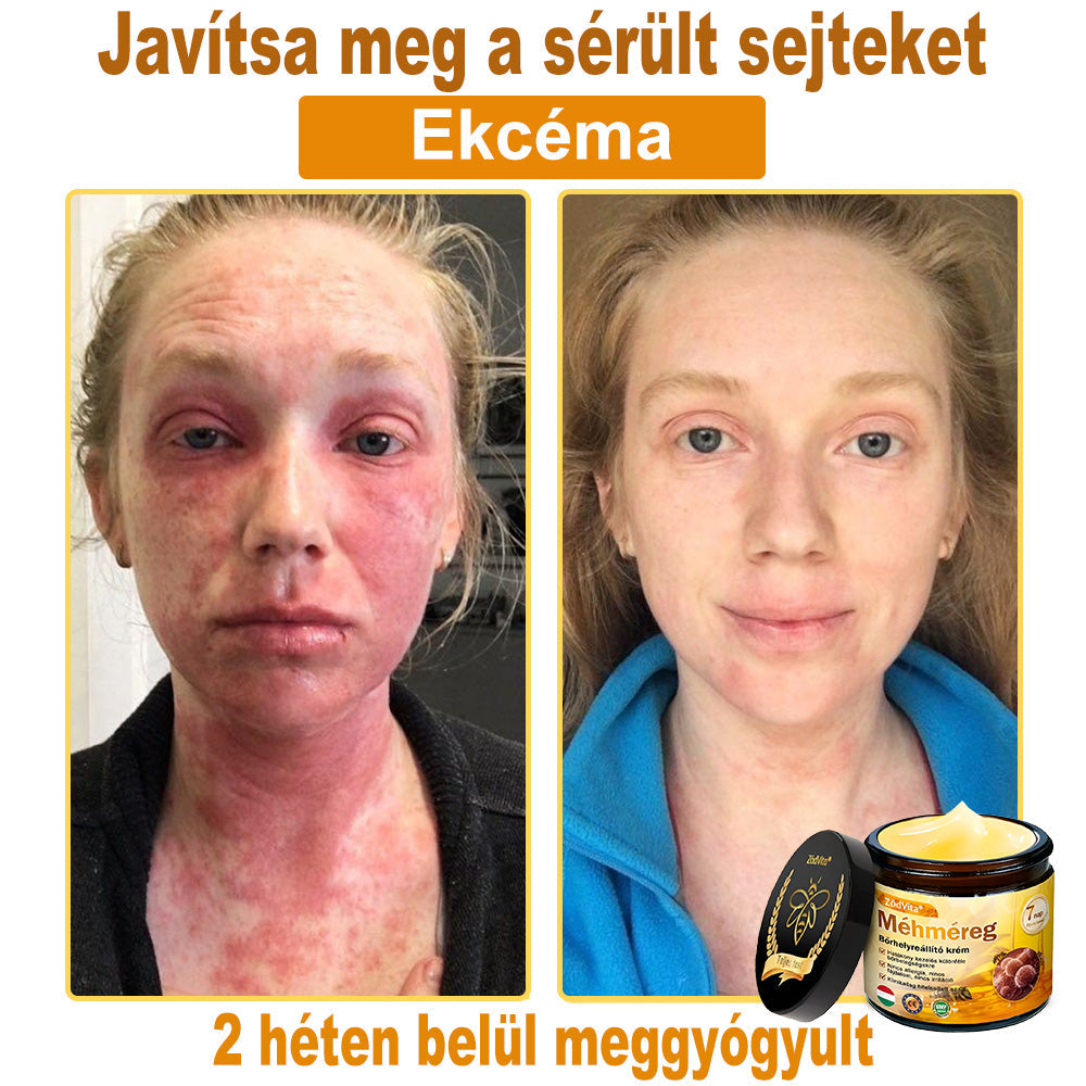 HU🐝✨ ZödVita® Méhméreg Bőr Helyreállító Krém 🔥 Magyar fejlesztés, magyarországi gyártás és szállítás