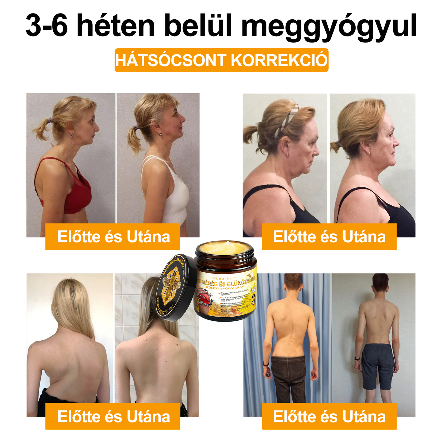 🐝🔥𝐈𝐳𝐮̈𝐥𝐞𝐭𝐢𝐕𝐢𝐭𝐚𝐥® 𝐌𝐞́𝐡 𝐌𝐞́𝐫𝐞𝐠 𝐈𝐳𝐮̈𝐥𝐞𝐭𝐢 𝐑𝐞𝐠𝐞𝐧𝐞𝐫𝐚́𝐥𝐨 𝐊𝐞𝐳𝐞𝐥𝐨̋ 𝐊𝐫𝐞́𝐦 (𝐔́𝐣-𝐙𝐞́𝐥𝐚𝐧𝐝𝐢 𝐌𝐞́𝐡 𝐊𝐢𝐯𝐨𝐧𝐚𝐭 - 𝐒𝐳𝐚𝐤𝐨𝐬𝐨𝐝𝐢𝐤 𝐨𝐫𝐭𝐨𝐩𝐞́𝐝 𝐛𝐞𝐭𝐞𝐠𝐬𝐞́𝐠𝐞𝐤𝐫𝐞 𝐞́𝐬 𝐢𝐳𝐮̈𝐥𝐞𝐭𝐢 𝐟𝐚́𝐣𝐝𝐚𝐥𝐨𝐦𝐫𝐚)