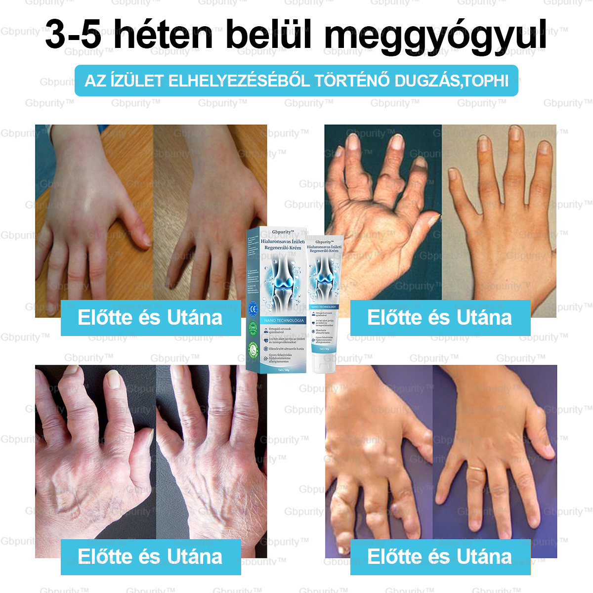 1️⃣ 𝐆𝐛𝐩𝐮𝐫𝐢𝐭𝐲™ 𝐇𝐢𝐚𝐥𝐮𝐫𝐨𝐧𝐬𝐚𝐯𝐚𝐬 Í𝐳ü𝐥𝐞𝐭𝐢 𝐑𝐞𝐠𝐞𝐧𝐞𝐫á𝐥ó 𝐊𝐫é𝐦👩⚕️(Á𝐭𝐟𝐨𝐠ó 𝐤𝐞𝐳𝐞𝐥é𝐬 𝐚𝐳 í𝐳ü𝐥𝐞𝐭𝐢 𝐠𝐲𝐮𝐥𝐥𝐚𝐝á𝐬𝐫𝐚, 𝐢𝐝𝐞𝐠𝐟á𝐣𝐝𝐚𝐥𝐨𝐦𝐫𝐚, 𝐢𝐳𝐨𝐦𝐟á𝐣𝐝𝐚𝐥𝐨𝐦𝐫𝐚)