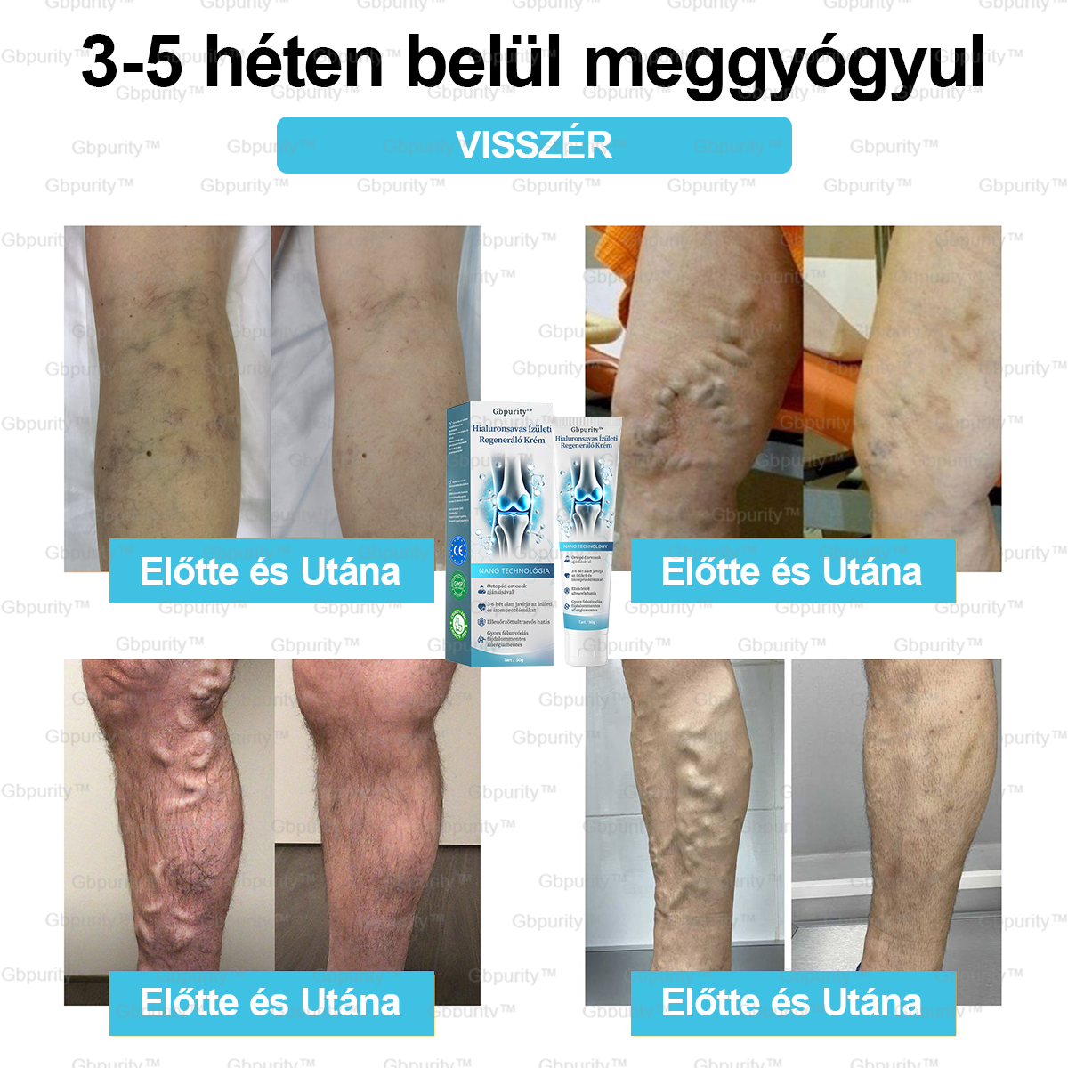 1️⃣ 𝐆𝐛𝐩𝐮𝐫𝐢𝐭𝐲™ 𝐇𝐢𝐚𝐥𝐮𝐫𝐨𝐧𝐬𝐚𝐯𝐚𝐬 Í𝐳ü𝐥𝐞𝐭𝐢 𝐑𝐞𝐠𝐞𝐧𝐞𝐫á𝐥ó 𝐊𝐫é𝐦👩⚕️(Á𝐭𝐟𝐨𝐠ó 𝐤𝐞𝐳𝐞𝐥é𝐬 𝐚𝐳 í𝐳ü𝐥𝐞𝐭𝐢 𝐠𝐲𝐮𝐥𝐥𝐚𝐝á𝐬𝐫𝐚, 𝐢𝐝𝐞𝐠𝐟á𝐣𝐝𝐚𝐥𝐨𝐦𝐫𝐚, 𝐢𝐳𝐨𝐦𝐟á𝐣𝐝𝐚𝐥𝐨𝐦𝐫𝐚)