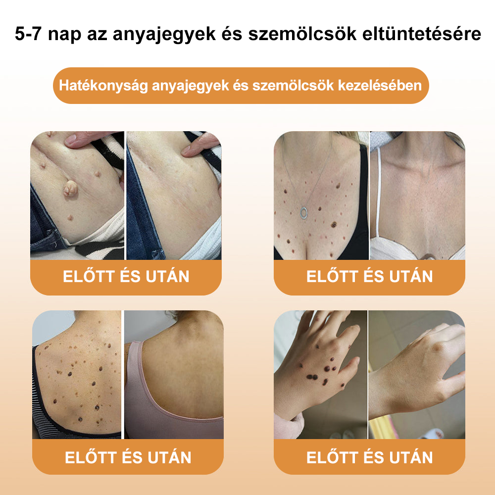 đ Mai kĂŒlönleges ajĂĄnlat: Az elsĆ 500 megrendelĆnknek dupla termĂ©ket adunk ajĂĄndĂ©kba!