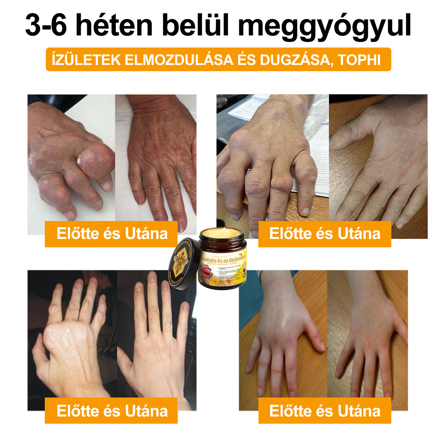 1️⃣ Gbpurity™ Méhmérég És Glükózamin Ízületi Gyógy Krém|TARTALMAZ MÉHMÉREG PEPTIDET, GLÜKÓZAMINT ÉS ARNIKÁT