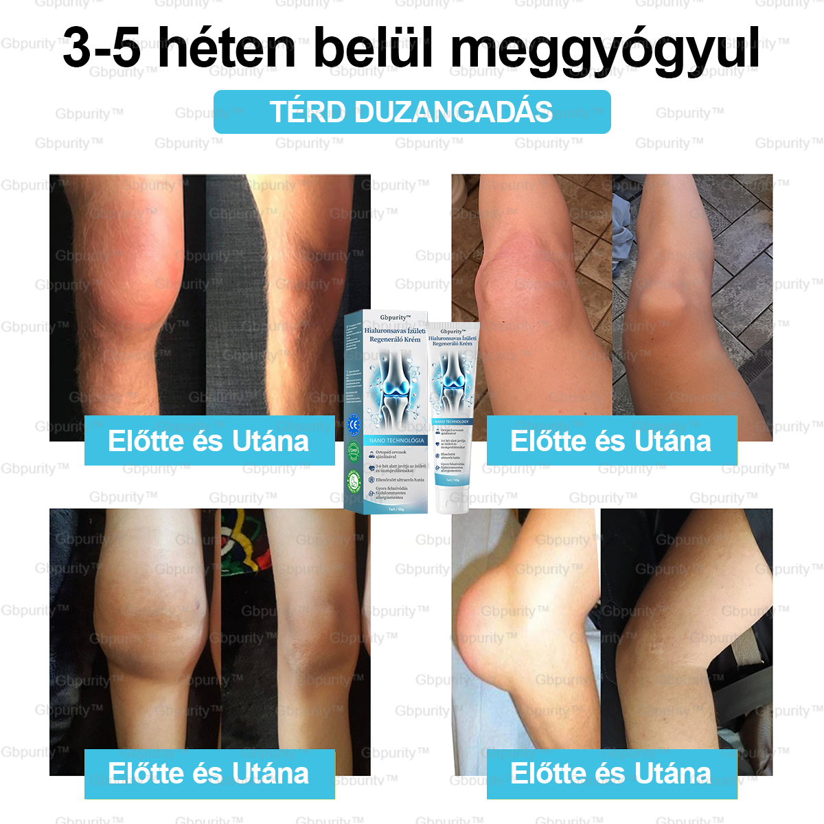 1️⃣ 𝐆𝐛𝐩𝐮𝐫𝐢𝐭𝐲™ 𝐇𝐢𝐚𝐥𝐮𝐫𝐨𝐧𝐬𝐚𝐯𝐚𝐬 Í𝐳ü𝐥𝐞𝐭𝐢 𝐑𝐞𝐠𝐞𝐧𝐞𝐫á𝐥ó 𝐊𝐫é𝐦👩⚕️(Á𝐭𝐟𝐨𝐠ó 𝐤𝐞𝐳𝐞𝐥é𝐬 𝐚𝐳 í𝐳ü𝐥𝐞𝐭𝐢 𝐠𝐲𝐮𝐥𝐥𝐚𝐝á𝐬𝐫𝐚, 𝐢𝐝𝐞𝐠𝐟á𝐣𝐝𝐚𝐥𝐨𝐦𝐫𝐚, 𝐢𝐳𝐨𝐦𝐟á𝐣𝐝𝐚𝐥𝐨𝐦𝐫𝐚)