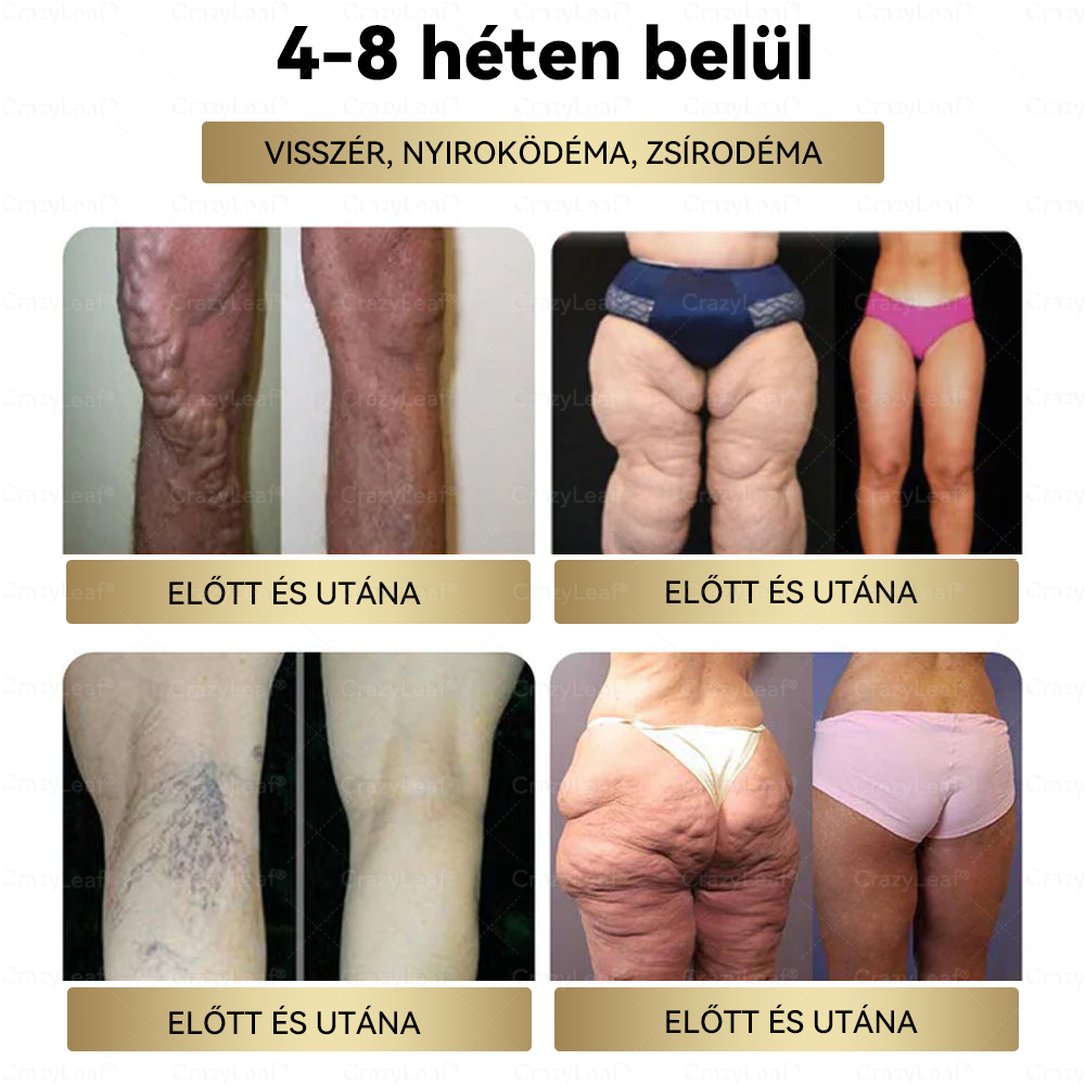Mayo Klinikajavasolt | Hivatalos Bolt | CrazyLeaf® GLP-1 & NAD Gyógyfüves Gomba Azonnali Kávé – Természetes Zsírégető, Öregedésgátló, Bélflóra Egészség & Probiotikumok Növelése