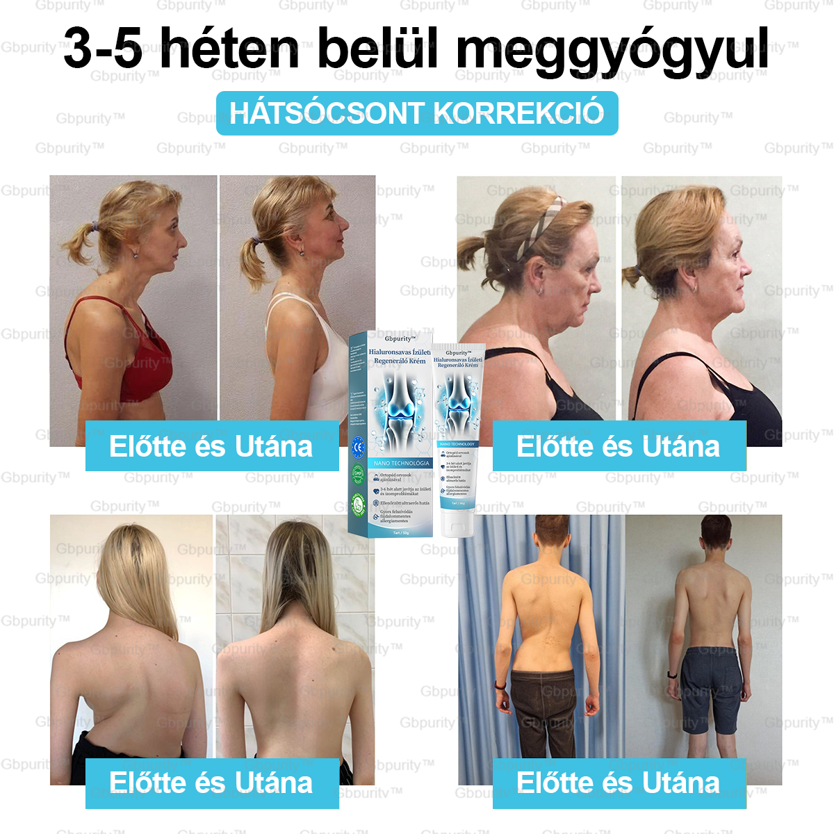 1️⃣ 𝐆𝐛𝐩𝐮𝐫𝐢𝐭𝐲™ 𝐇𝐢𝐚𝐥𝐮𝐫𝐨𝐧𝐬𝐚𝐯𝐚𝐬 Í𝐳ü𝐥𝐞𝐭𝐢 𝐑𝐞𝐠𝐞𝐧𝐞𝐫á𝐥ó 𝐊𝐫é𝐦👩⚕️(Á𝐭𝐟𝐨𝐠ó 𝐤𝐞𝐳𝐞𝐥é𝐬 𝐚𝐳 í𝐳ü𝐥𝐞𝐭𝐢 𝐠𝐲𝐮𝐥𝐥𝐚𝐝á𝐬𝐫𝐚, 𝐢𝐝𝐞𝐠𝐟á𝐣𝐝𝐚𝐥𝐨𝐦𝐫𝐚, 𝐢𝐳𝐨𝐦𝐟á𝐣𝐝𝐚𝐥𝐨𝐦𝐫𝐚)