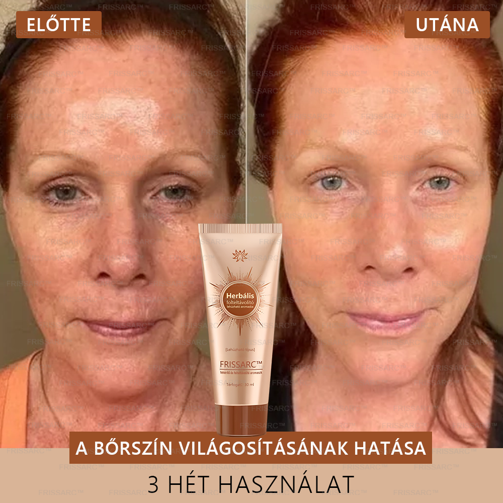 FRISSARC™ fehérítő és folteltávolító arcmaszk –👩⚕️Természetes összetevők tartósan eltüntetik a foltokat, szeplőket és napfoltokat.