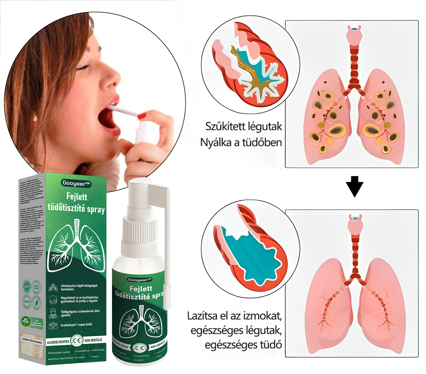 🍀𝐆𝐨𝐨𝐲𝐞𝐞𝐫™ Fejlett Tüdőtisztító Spray -Támogatja a tüdő, a hörgők és az orrmelléküregek egészségét, elősegíti a légzőrendszer egészségét és a könnyebb légzést