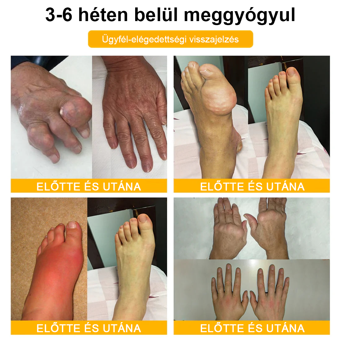 Gbpurity® Botulinum Toxin & Méhméreg Fájdalomcsillapító Krém – Hivatalos Márkabolt, MOT Jóváhagyással