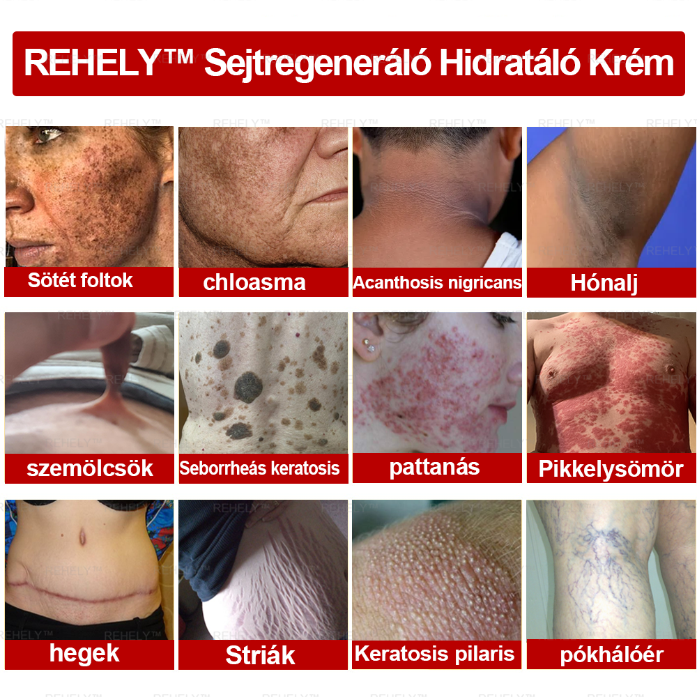 🌺REHELY™ Sejtregeneráló Hidratáló Krém