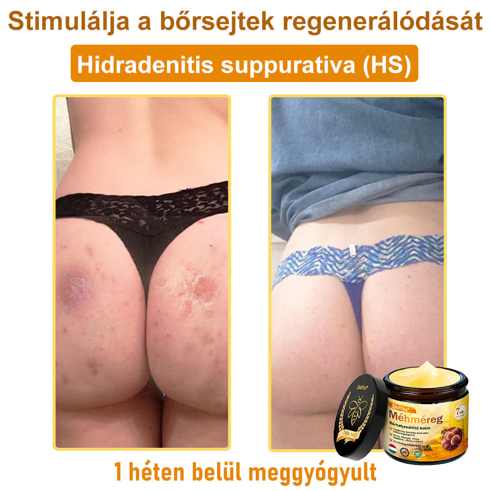 HU🐝✨ ZödVita® Méhméreg Bőr Helyreállító Krém 🔥 Magyar fejlesztés, magyarországi gyártás és szállítás
