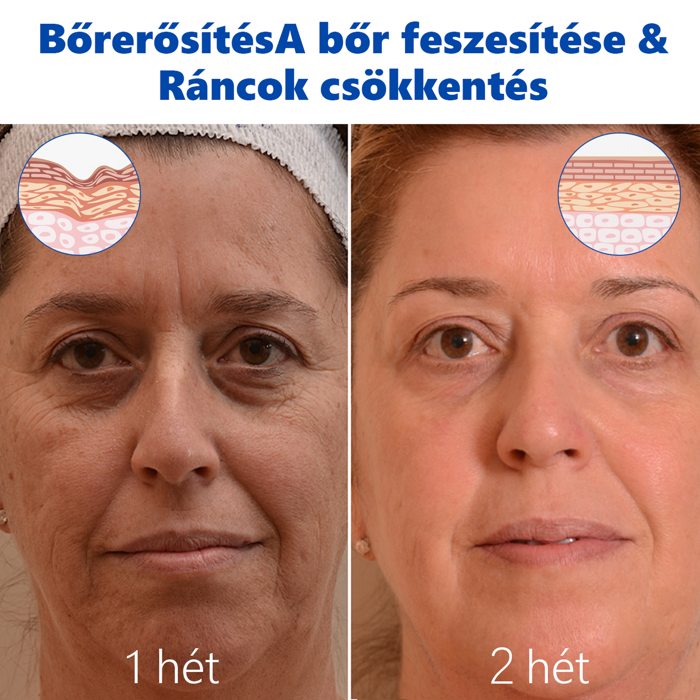 ⚫REHELY™ Háromszoros Regeneráló Hidratáló Krém|BOTOX,RETINOL&HIALURONSAV|Mélyhidratálás és táplálásTudományosan bizonyított formula