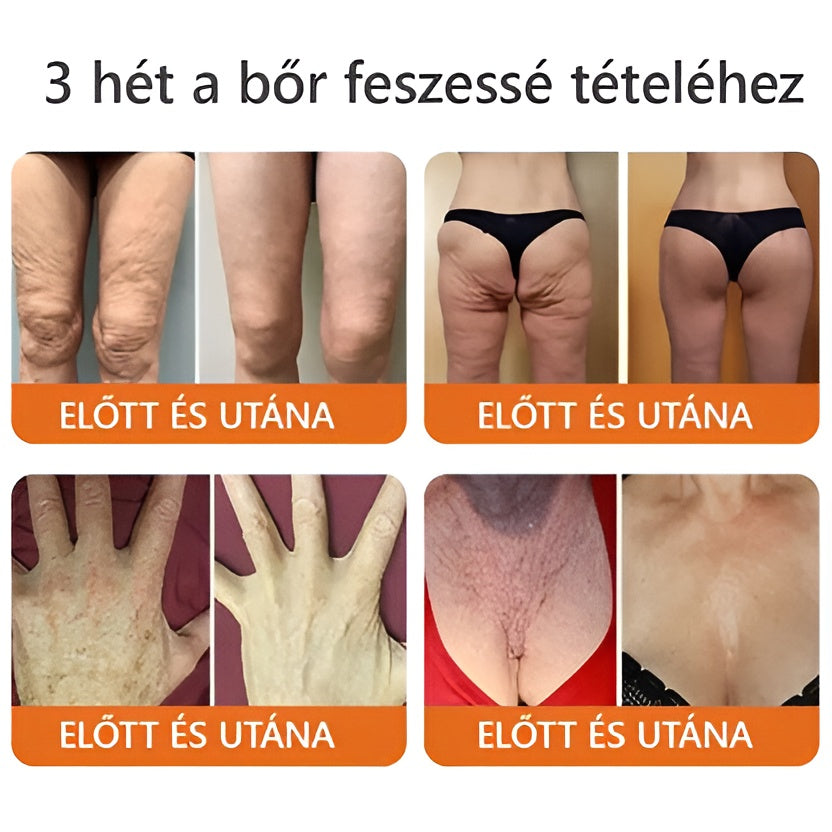 🌟 ZödVita® Méhméreg Bőr Helyreállító Krém ✔️Természetes Öregedésgátló, Feszesíti a Bőrt, Csökkenti a Ráncokat– 50ml