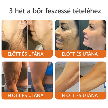🌟 ZödVita® Méhméreg Bőr Helyreállító Krém ✔️Természetes Öregedésgátló, Feszesíti a Bőrt, Csökkenti a Ráncokat– 50ml