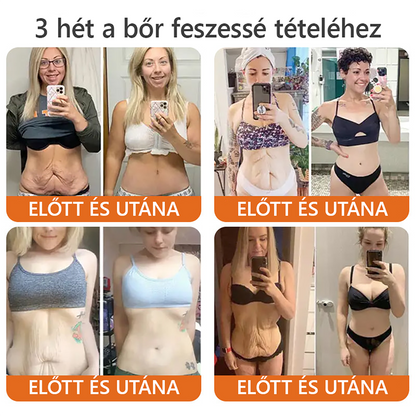 🌟 ZödVita® Méhméreg Bőr Helyreállító Krém ✔️Természetes Öregedésgátló, Feszesíti a Bőrt, Csökkenti a Ráncokat– 50ml