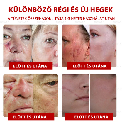 🌺REHELY™ Sejtregeneráló Hidratáló Krém | Tisztán vegán, állatkísérlet-mentes