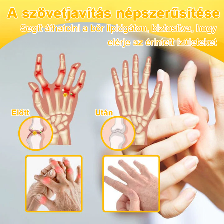 Gbpurity® Botulinum Toxin & Méhméreg Fájdalomcsillapító Krém – Hivatalos Márkabolt, MOT Jóváhagyással