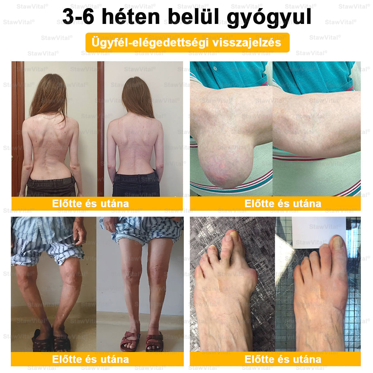 𝑺𝒕𝒂𝒘𝑽𝒊𝒕𝒂𝒍® Botoxot és Méhmérget Tartalmazó Regeneráló Krém Ízületekre és Csontokra | MOT (Magyar Ortopéd Társaság) által tanúsított termék