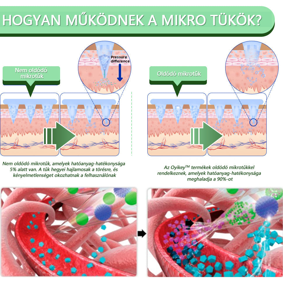 001[Lásd az eredményeket 7 nap múlva]🌲Voilaist® SMGT-GLP-1 nano mikrotűs tapasz (Fájdalommentes, hosszan tartó, kezeli a cukorbetegséget, az elhízást és a szív- és érrendszeri betegségeket)