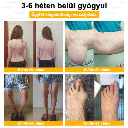 🟢𝑺𝒕𝒂𝒘𝑽𝒊𝒕𝒂𝒍® Botoxot és Méhmérget Tartalmazó Regeneráló Krém Ízületekre és Csontokra | MOT (Magyar Ortopéd Társaság) által tanúsított termék