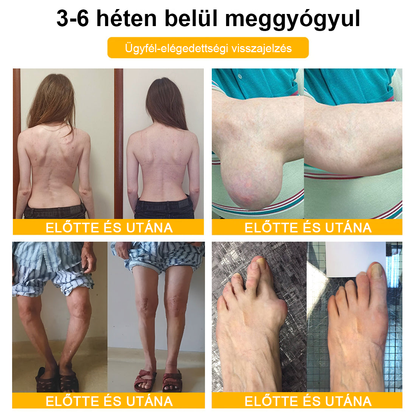 Gbpurity® Botulinum Toxin & Méhméreg Fájdalomcsillapító Krém – Hivatalos Márkabolt, MOT Jóváhagyással