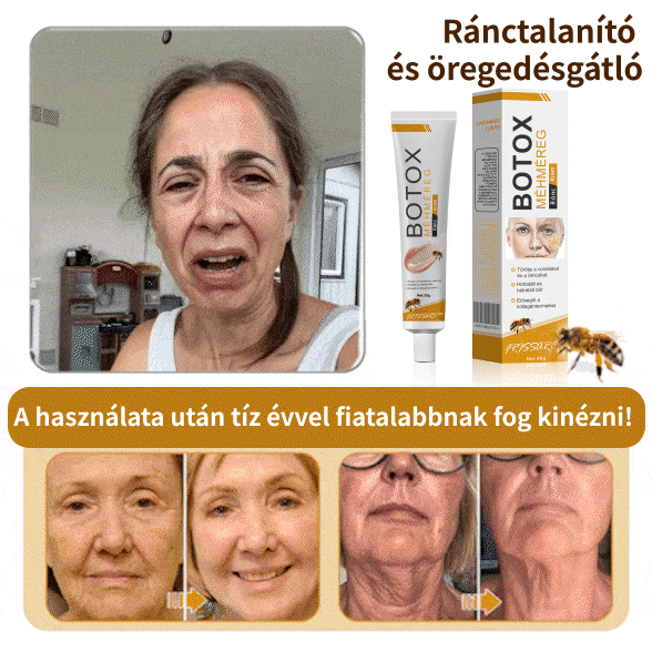 FrissArc™ Botox Méhméreg Ránctalanító Krém ☀️🌙 egész napos bőrápolás!