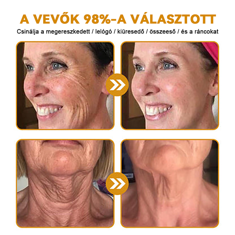FrissArc™ Botox Méhméreg Ránctalanító Krém ☀️🌙 egész napos bőrápolás!