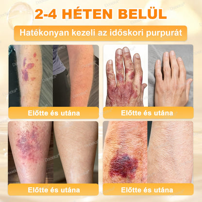 Dooeka® 𝟖-𝐈𝐧-𝟏 Méhméreg & Tallow Bőrfirmító és Regeneráló Krém 💥 (7 napon belül hatékony) Méhméreg + Tallow · 7X Mélyhidratálás, célozza meg a ráncokat, megereszkedést, striákat, sötét foltokat, purpurát, gyulladásokat és még sok mást.