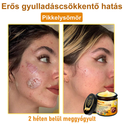 HU🐝✨ ZödVita® Méhméreg Bőr Helyreállító Krém 🔥 Magyar fejlesztés, magyarországi gyártás és szállítás