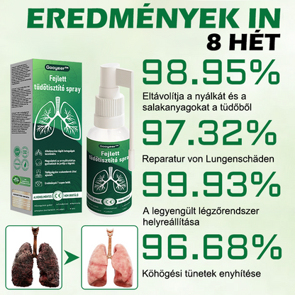 🍀𝐆𝐨𝐨𝐲𝐞𝐞𝐫™ Fejlett Tüdőtisztító Spray -Támogatja a tüdő, a hörgők és az orrmelléküregek egészségét, elősegíti a légzőrendszer egészségét és a könnyebb légzést