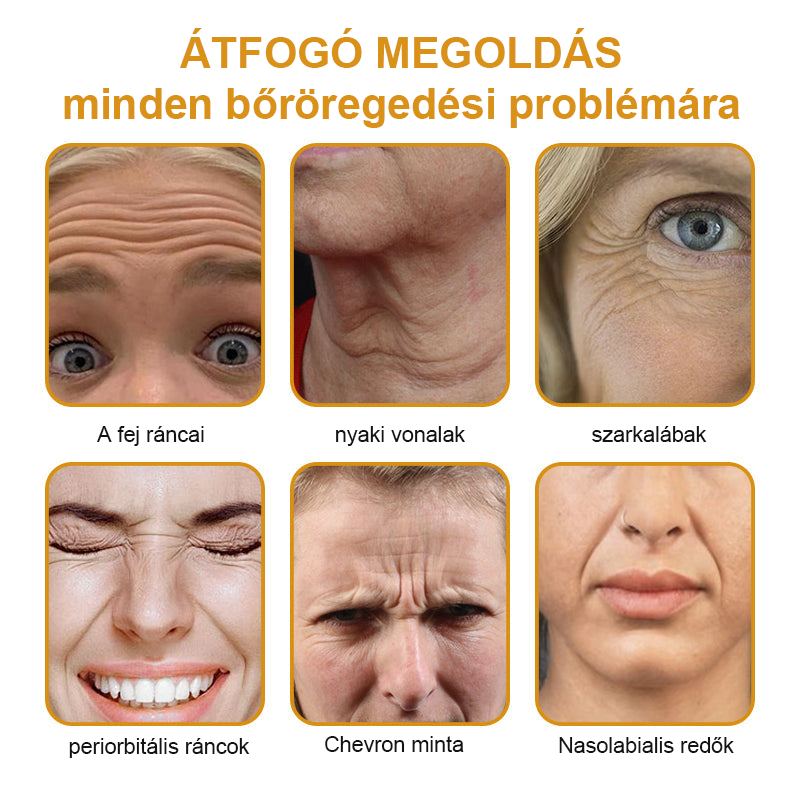 🏵️FRISSARC™ Botox Méhméreg Ránctalanító Krém