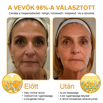 FrissArc™ Botox Méhméreg Ránctalanító Krém — Ráncok csökkentése, bőr feszesítése és világosítása, Kétszeres hatású anti-aging krém