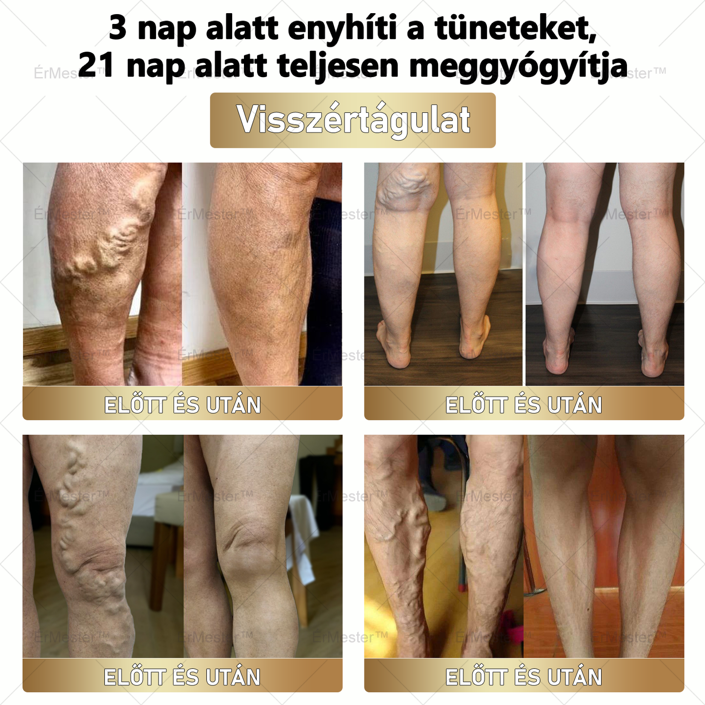 ⭐ ÉrMester™  Természetes Vénás Javító Lábfürdő Gélgolyók