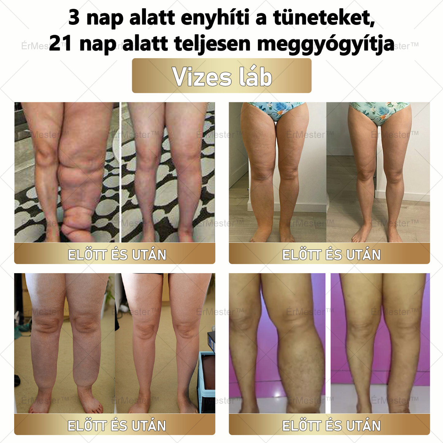 ⭐ ÉrMester™  Természetes Vénás Javító Lábfürdő Gélgolyók