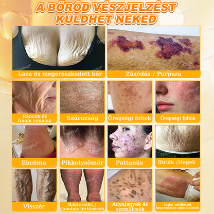 Dooeka® 𝟖-𝐈𝐧-𝟏 Méhméreg & Tallow Bőrfirmító és Regeneráló Krém 💥 (7 napon belül hatékony) Méhméreg + Tallow · 7X Mélyhidratálás, célozza meg a ráncokat, megereszkedést, striákat, sötét foltokat, purpurát, gyulladásokat és még sok mást.