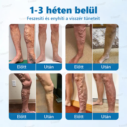 💙💙Trimil® VeinGuard Gyógynövényes Spray-✅ Klinikailag bizonyított, hogy mindössze 7 nap alatt megszünteti a visszereket!