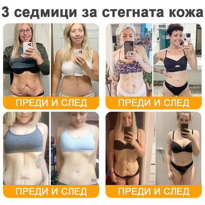 REHELY® Крем с пчелна отрова за регенерация на кожата – Подходящ за всички възрасти и типове кожа)