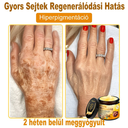 HU🐝✨ ZödVita® Méhméreg Bőr Helyreállító Krém 🔥 Magyar fejlesztés, magyarországi gyártás és szállítás