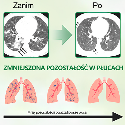 PL🌿𝐆𝐨𝐨𝐲𝐞𝐞𝐫™ Zaawansowany spray do oczyszczania płuc- Zdrowie płuc - wsparcie immunologiczne, detoksykacja i wsparcie oddechowe - Certyfikat CE